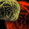 What Are Some Common Types of Brain Disorders?