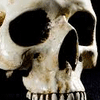 The Number of Bones in the Human Body